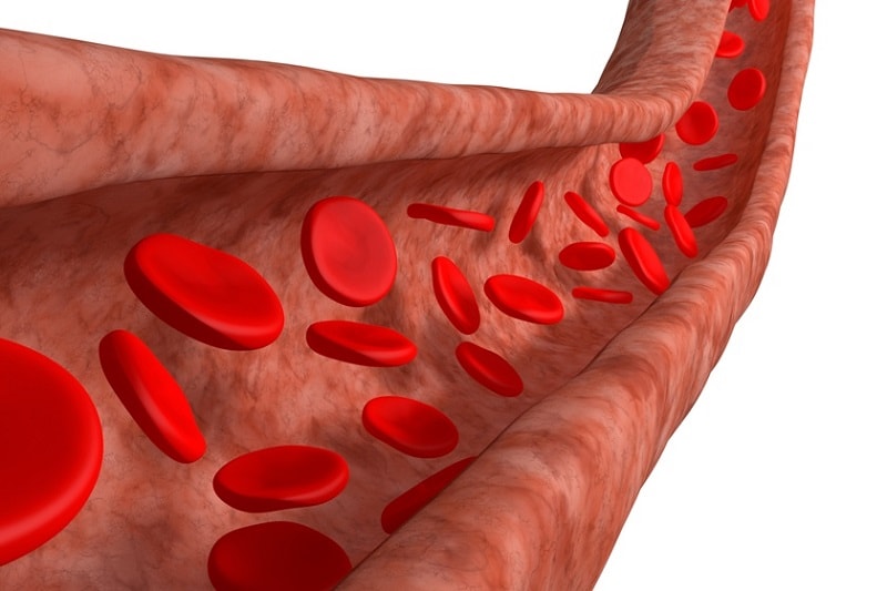 أمراض الأوعية الدموية
