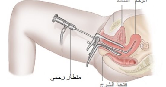 ما هو المنظار الرحمي ؟